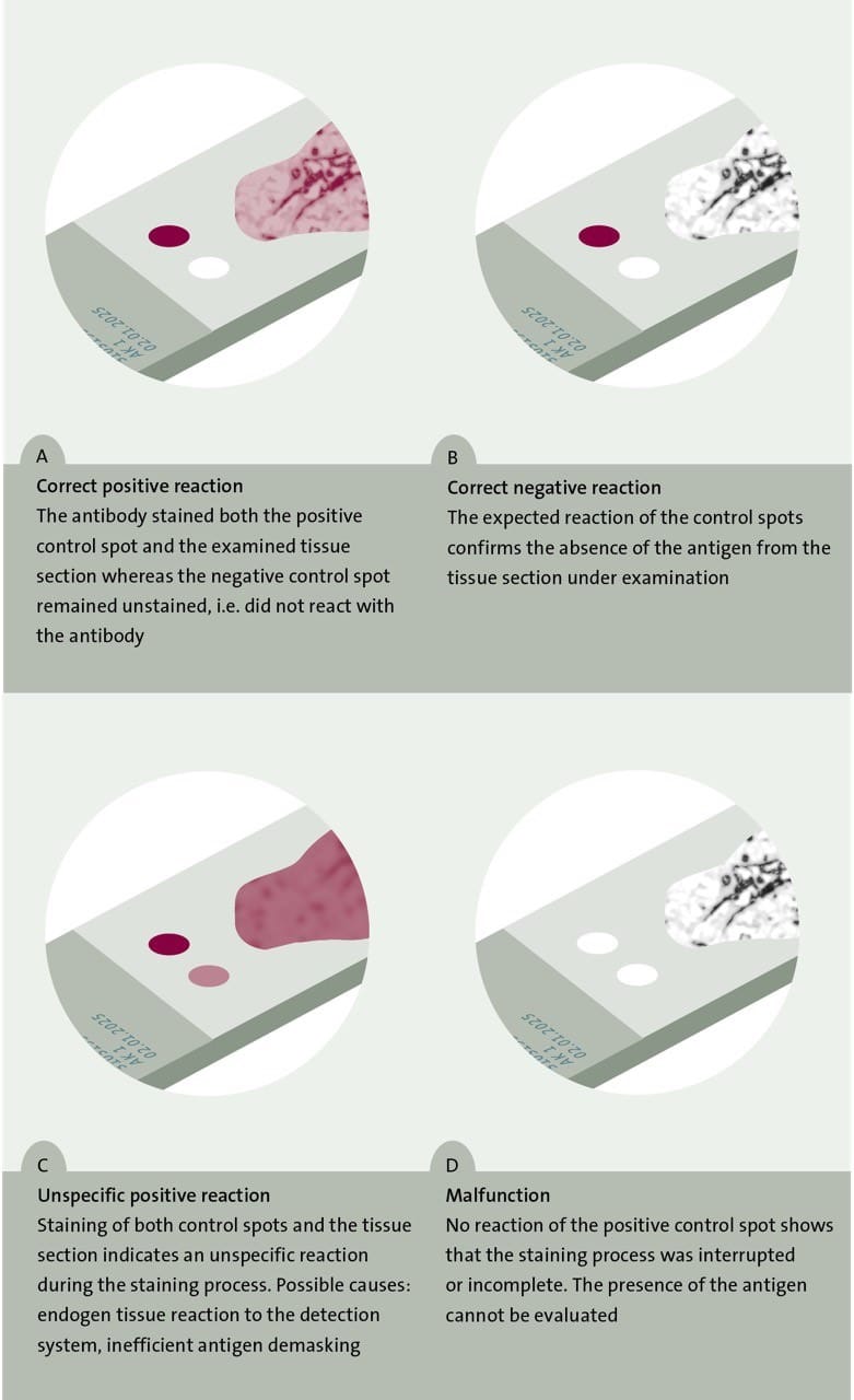 Icon TMA Process Graphic