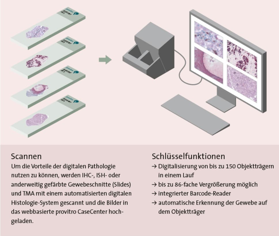 Grafik mit Text: Scannen, Management und Auswertung eines Gewebeschnittes