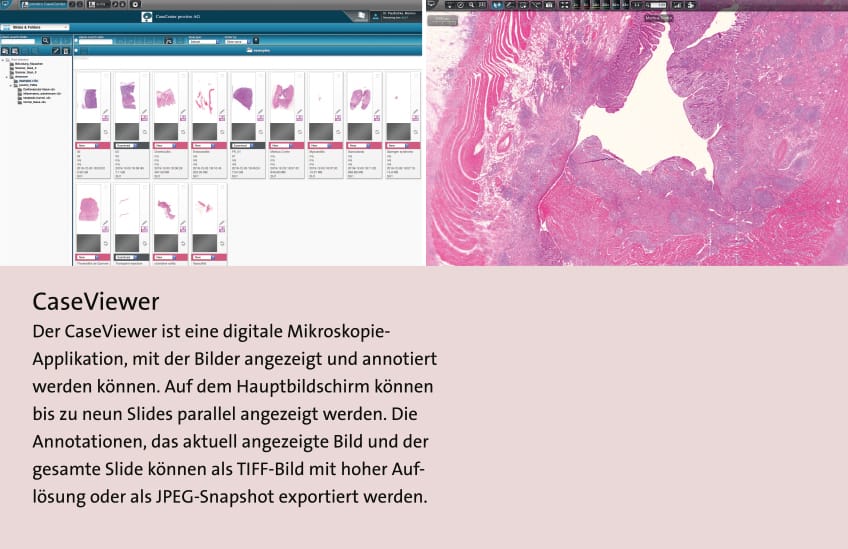 Grafik mit Text: Scannen, Management und Auswertung eines Gewebeschnittes